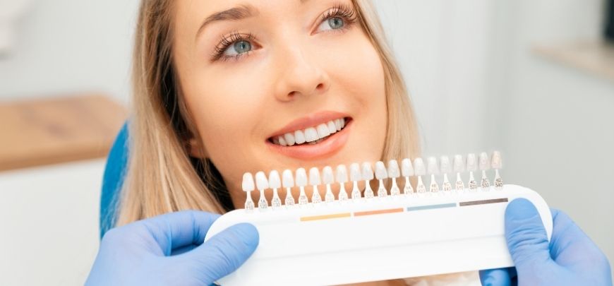 diseño de sonrisa en tunja