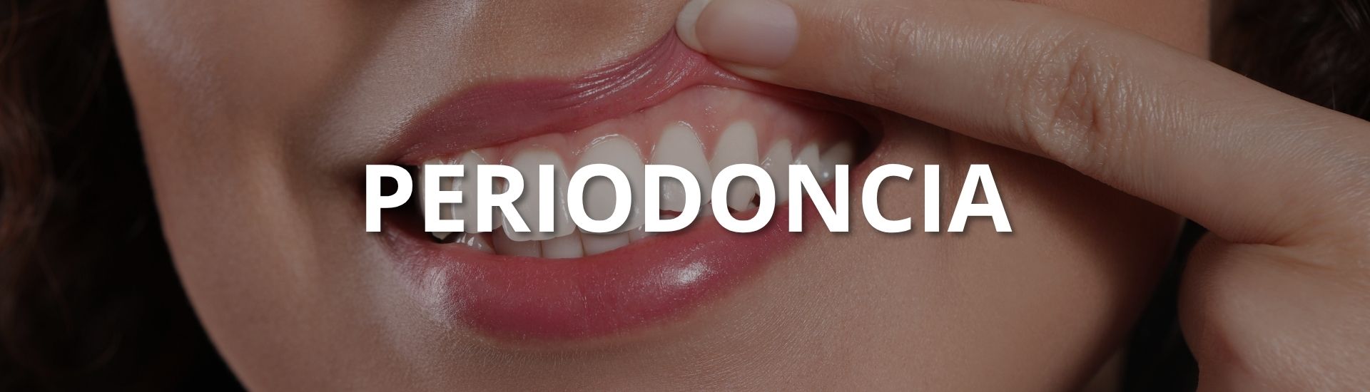 periodoncia en neiva